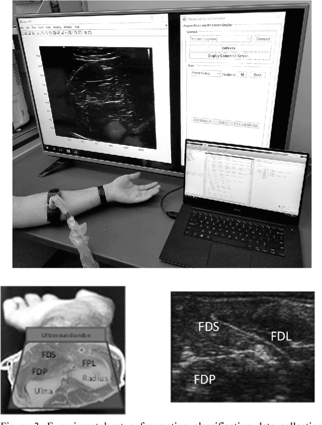 Figure 3 for Sparsity Analysis of a Sonomyographic Muscle-Computer Interface