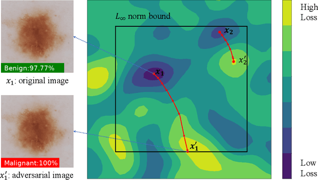 Figure 3 for Towards Evaluating the Robustness of Deep Diagnostic Models by Adversarial Attack