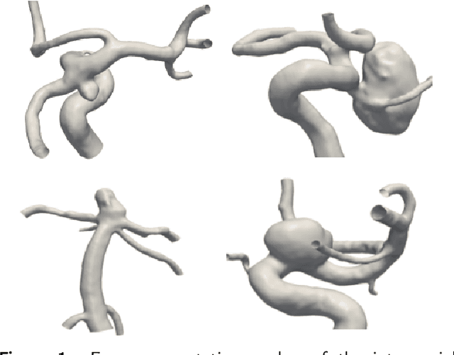 Figure 1 for MedMeshCNN -- Enabling MeshCNN for Medical Surface Models