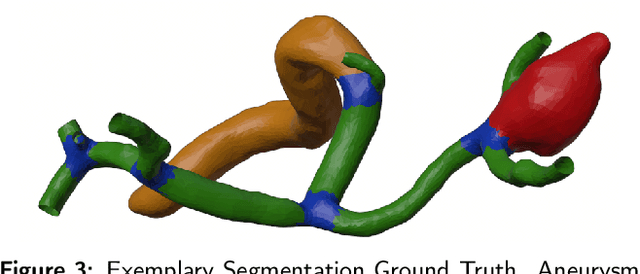 Figure 4 for MedMeshCNN -- Enabling MeshCNN for Medical Surface Models