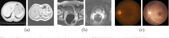 Figure 3 for Source-Free Unsupervised Domain Adaptation with Norm and Shape Constraints for Medical Image Segmentation