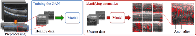 Figure 1 for Unsupervised Anomaly Detection with Generative Adversarial Networks to Guide Marker Discovery