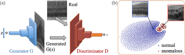 Figure 3 for Unsupervised Anomaly Detection with Generative Adversarial Networks to Guide Marker Discovery