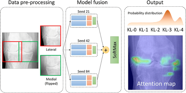 Figure 1 for Automatic Knee Osteoarthritis Diagnosis from Plain Radiographs: A Deep Learning-Based Approach