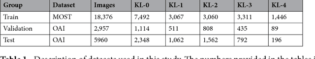Figure 2 for Automatic Knee Osteoarthritis Diagnosis from Plain Radiographs: A Deep Learning-Based Approach