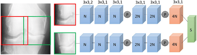 Figure 4 for Automatic Knee Osteoarthritis Diagnosis from Plain Radiographs: A Deep Learning-Based Approach