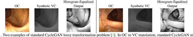 Figure 1 for Augmenting Colonoscopy using Extended and Directional CycleGAN for Lossy Image Translation