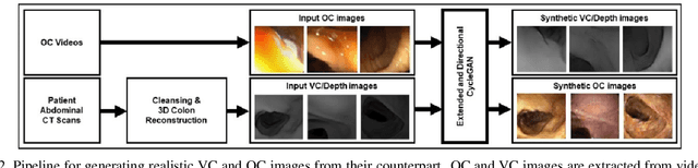 Figure 2 for Augmenting Colonoscopy using Extended and Directional CycleGAN for Lossy Image Translation