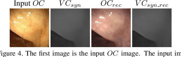 Figure 4 for Augmenting Colonoscopy using Extended and Directional CycleGAN for Lossy Image Translation