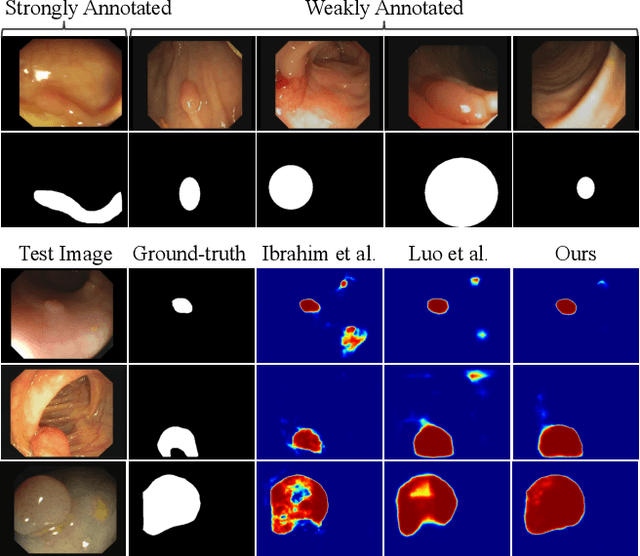 Figure 1 for Label-efficient Hybrid-supervised Learning for Medical Image Segmentation