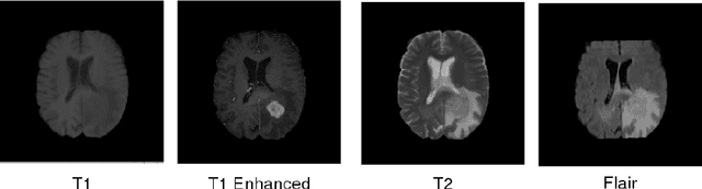 Figure 1 for Multi Modal Convolutional Neural Networks for Brain Tumor Segmentation