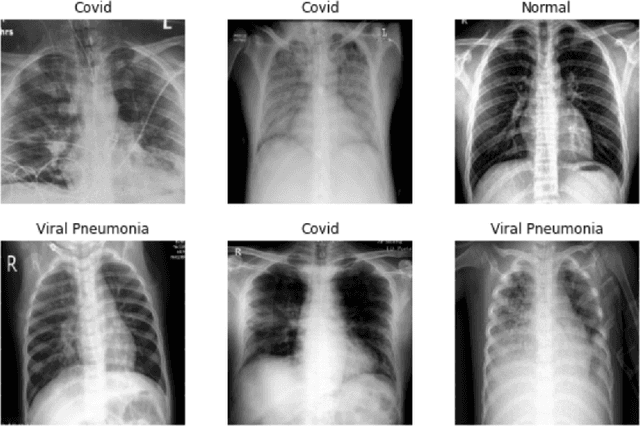 Figure 1 for COVID-19 detection from scarce chest x-ray image data using few-shot deep learning approach