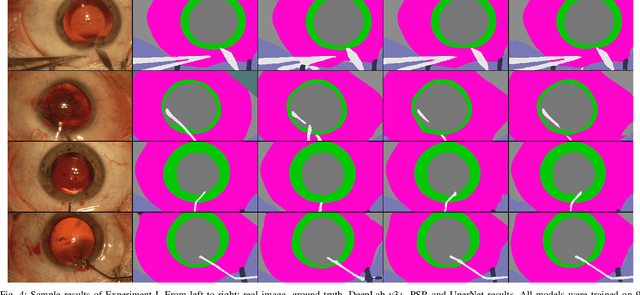 Figure 4 for CaDIS: Cataract Dataset for Image Segmentation