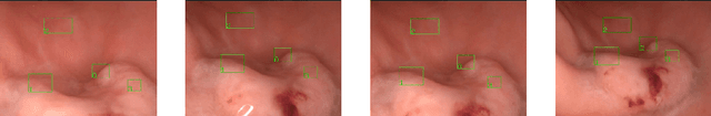 Figure 1 for A Real-Time Region Tracking Algorithm Tailored to Endoscopic Video with Open-Source Implementation