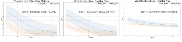 Figure 3 for Improving Model Accuracy for Imbalanced Image Classification Tasks by Adding a Final Batch Normalization Layer: An Empirical Study