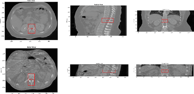Figure 3 for An improved 3D region detection network: automated detection of the 12th thoracic vertebra in image guided radiation therapy