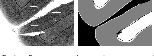 Figure 3 for Parcellation of Visual Cortex on high-resolution histological Brain Sections using Convolutional Neural Networks