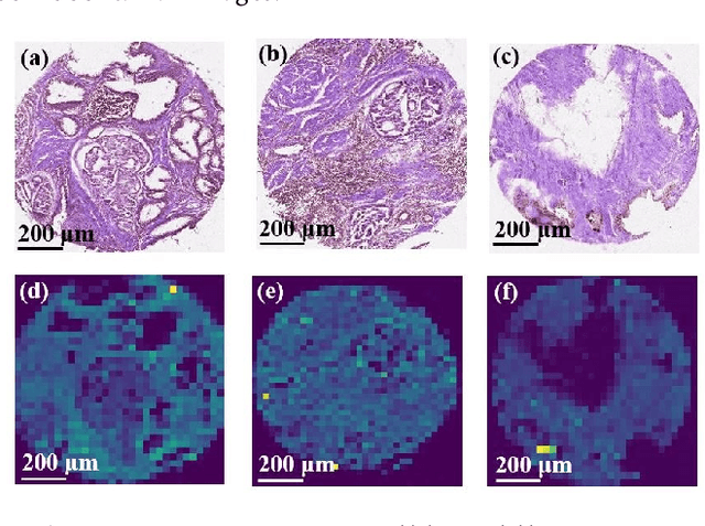 Figure 2 for Feature Fusion of Raman Chemical Imaging and Digital Histopathology using Machine Learning for Prostate Cancer Detection