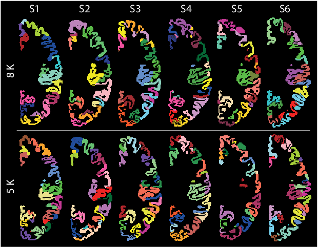 Figure 1 for Graph Spectral Characterization of Brain Cortical Morphology