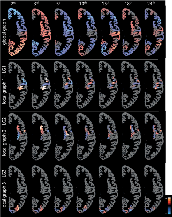 Figure 3 for Graph Spectral Characterization of Brain Cortical Morphology