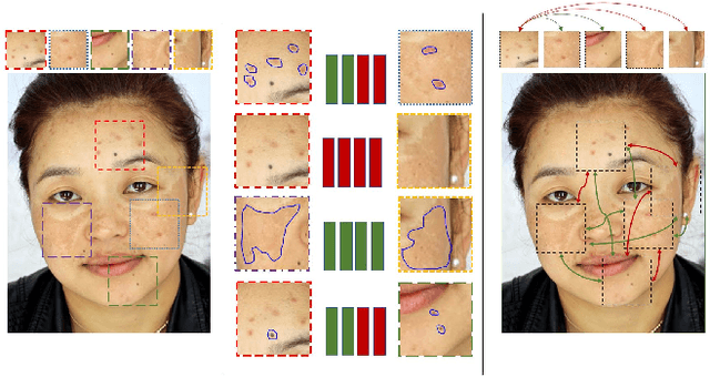 Figure 1 for RethNet: Object-by-Object Learning for Detecting Facial Skin Problems