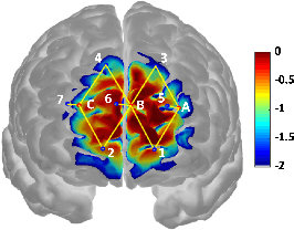 Figure 1 for Pain Detection with fNIRS-Measured Brain Signals: A Personalized Machine Learning Approach Using the Wavelet Transform and Bayesian Hierarchical Modeling with Dirichlet Process Priors