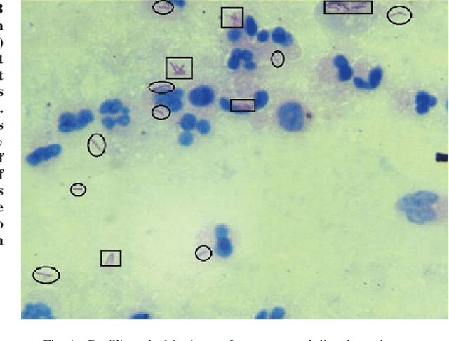 Figure 1 for Towards Automated Tuberculosis detection using Deep Learning