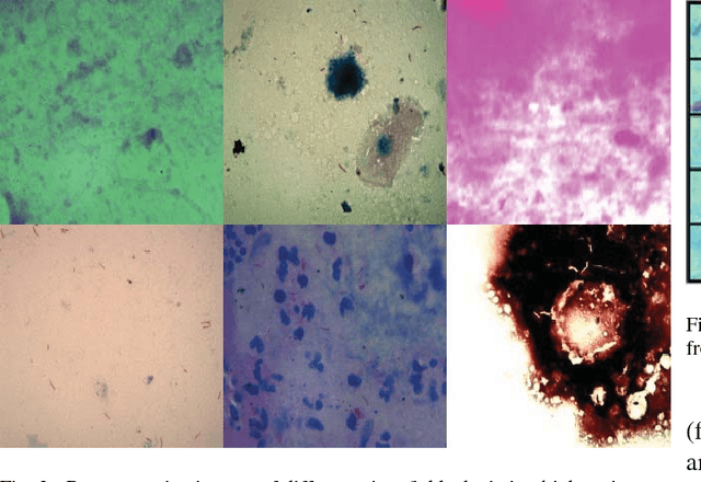 Figure 2 for Towards Automated Tuberculosis detection using Deep Learning