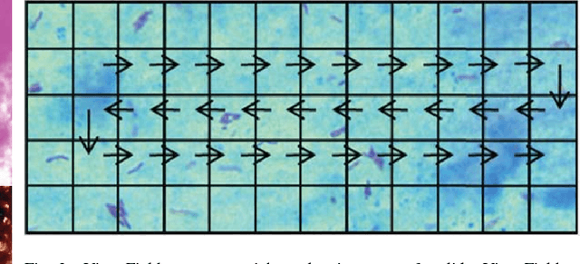 Figure 3 for Towards Automated Tuberculosis detection using Deep Learning