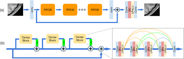 Figure 3 for Enhanced generative adversarial network for 3D brain MRI super-resolution