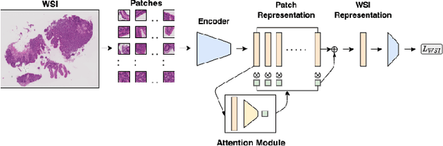 Figure 1 for HistoTransfer: Understanding Transfer Learning for Histopathology