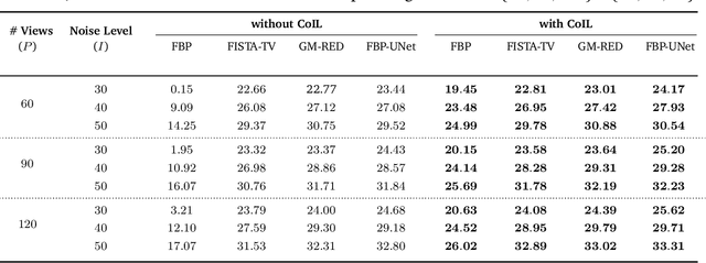 Figure 4 for CoIL: Coordinate-based Internal Learning for Imaging Inverse Problems