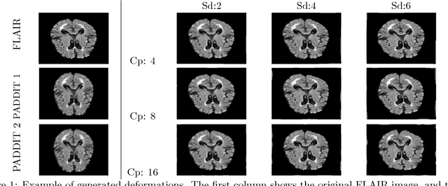 Figure 1 for PADDIT: Probabilistic Augmentation of Data using Diffeomorphic Image Transformation