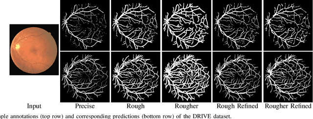 Figure 4 for Weakly-Supervised Crack Detection