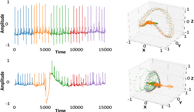 Figure 3 for Unsupervised non-parametric change point detection in quasi-periodic signals