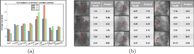 Figure 4 for Direct Quantification for Coronary Artery Stenosis Using Multiview Learning