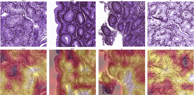 Figure 2 for Deep Learning for Visual Recognition of Environmental Enteropathy and Celiac Disease