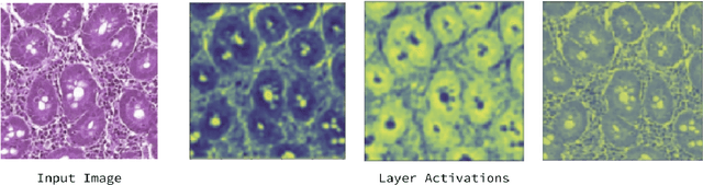 Figure 4 for Deep Learning for Visual Recognition of Environmental Enteropathy and Celiac Disease