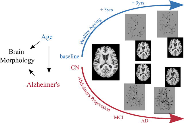 Figure 3 for Causal Machine Learning for Healthcare and Precision Medicine