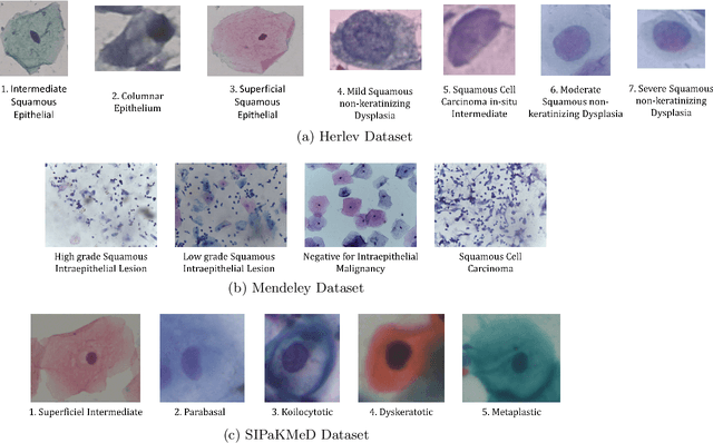 Figure 3 for Cervical Cytology Classification Using PCA & GWO Enhanced Deep Features Selection