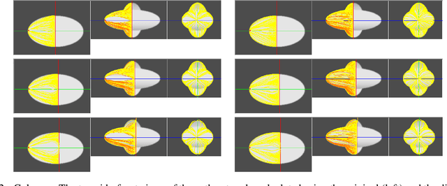 Figure 2 for Surface Segmentation Using Implicit Divergence Constraint Between Adjacent Minimal Paths