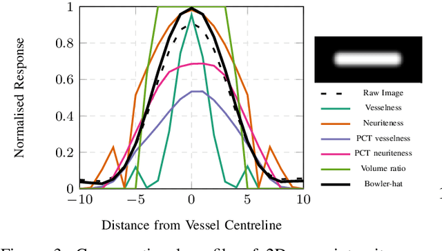 Figure 3 for The Multiscale Bowler-Hat Transform for Vessel Enhancement in 3D Biomedical Images