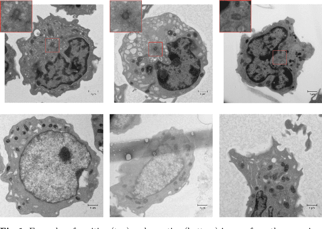 Figure 1 for Synthetic patches, real images: screening for centrosome aberrations in EM images of human cancer cells