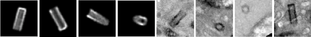 Figure 3 for Synthetic patches, real images: screening for centrosome aberrations in EM images of human cancer cells