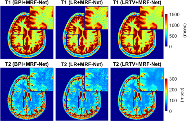 Figure 4 for Deep MR Fingerprinting with total-variation and low-rank subspace priors