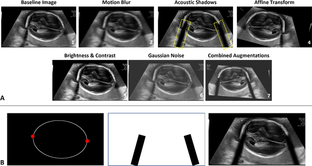 Figure 3 for Towards A Device-Independent Deep Learning Approach for the Automated Segmentation of Sonographic Fetal Brain Structures: A Multi-Center and Multi-Device Validation