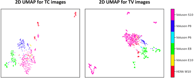 Figure 4 for Towards A Device-Independent Deep Learning Approach for the Automated Segmentation of Sonographic Fetal Brain Structures: A Multi-Center and Multi-Device Validation