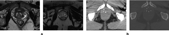 Figure 1 for Deep generative model-driven multimodal prostate segmentation in radiotherapy