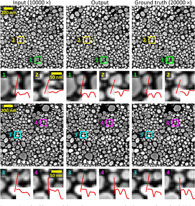 Figure 2 for Resolution enhancement in scanning electron microscopy using deep learning
