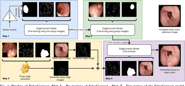 Figure 1 for PolypConnect: Image inpainting for generating realistic gastrointestinal tract images with polyps